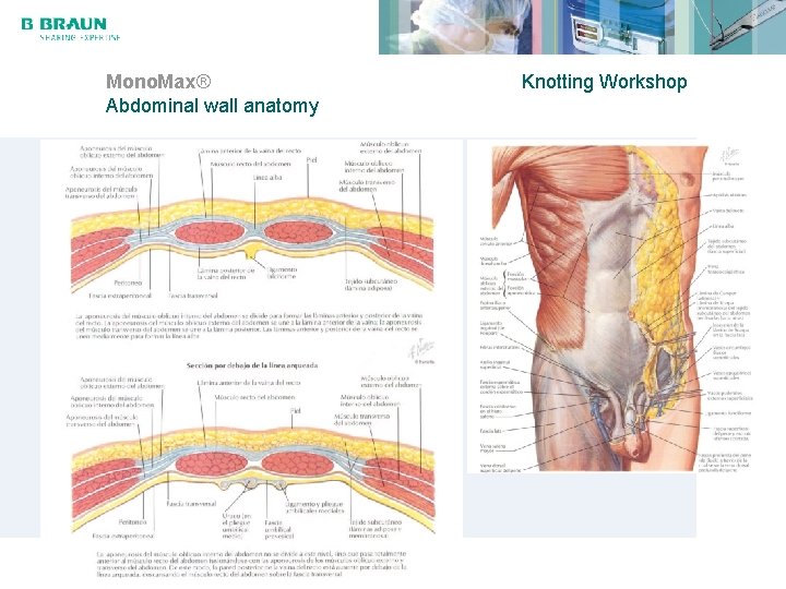 Mono. Max® Abdominal wall anatomy Knotting Workshop 