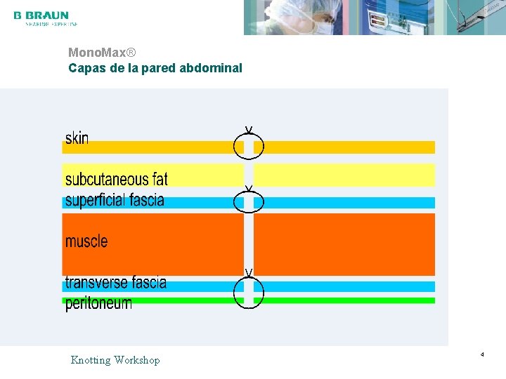 Mono. Max® Capas de la pared abdominal Knotting Workshop 4 