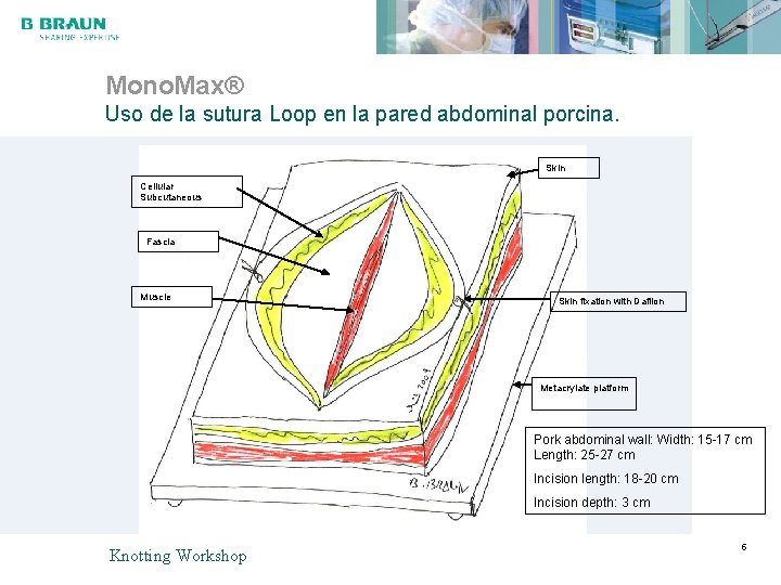 Mono. Max® Uso de la sutura Loop en la pared abdominal porcina. Skin Cellular