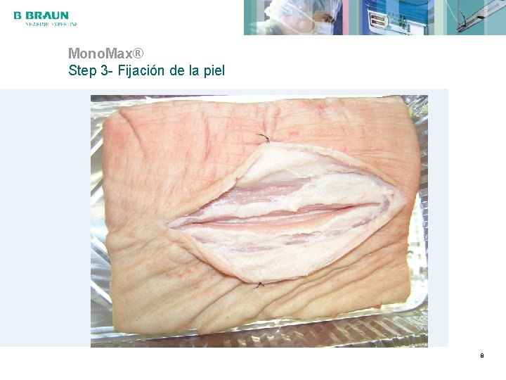 Mono. Max® Step 3 - Fijación de la piel 8 