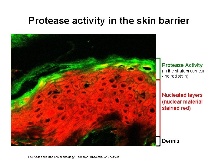 Protease activity in the skin barrier Protease Activity (in the stratum corneum - no