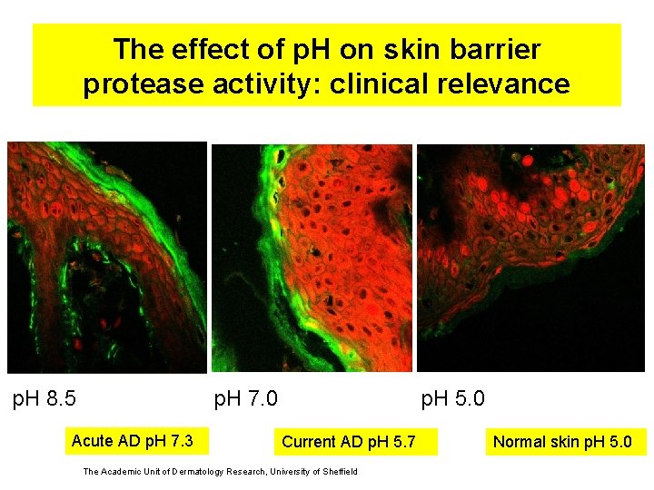 The effect of p. H on skin barrier protease activity: clinical relevance p. H
