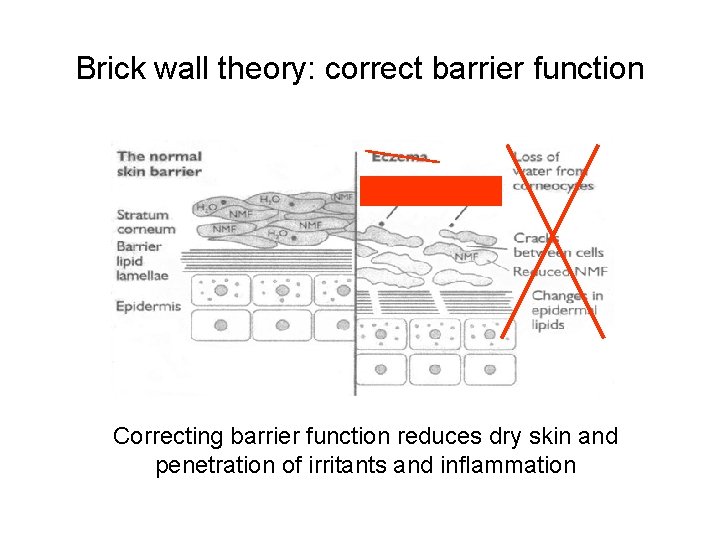 Brick wall theory: correct barrier function Correcting barrier function reduces dry skin and penetration