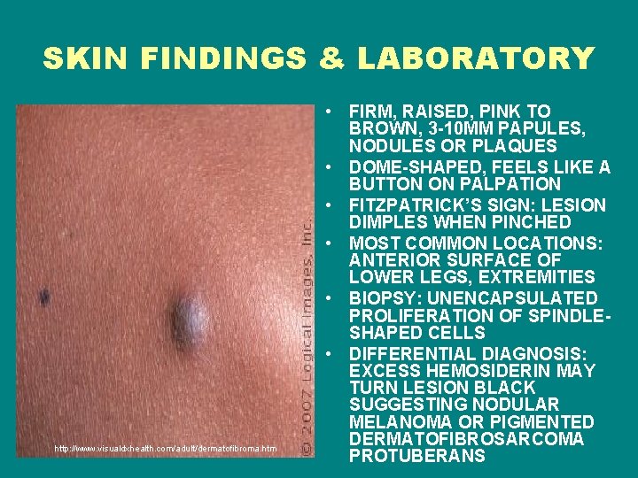 SKIN FINDINGS & LABORATORY http: //www. visualdxhealth. com/adult/dermatofibroma. htm • FIRM, RAISED, PINK TO