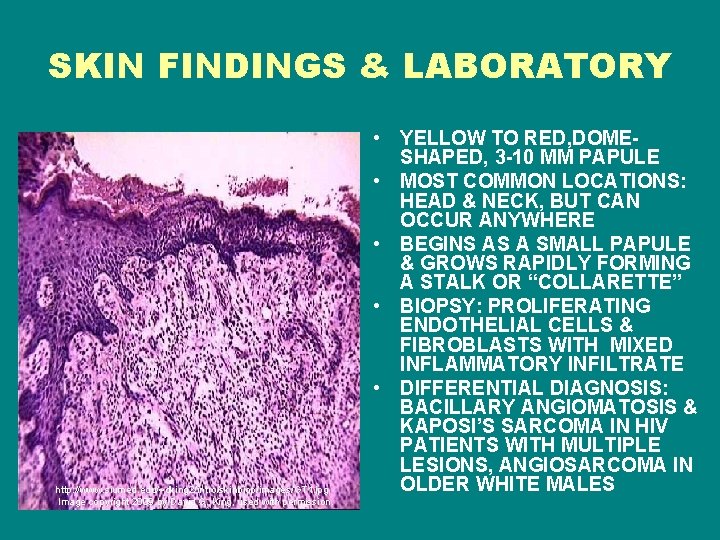 SKIN FINDINGS & LABORATORY http: //www. siumed. edu/~dking 2/intro/skinbiop/images/GT 1. jpg Image copyright 2009