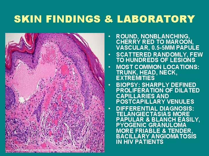 SKIN FINDINGS & LABORATORY • ROUND, NONBLANCHING, CHERRY RED TO MAROON, VASCULAR, 0. 5