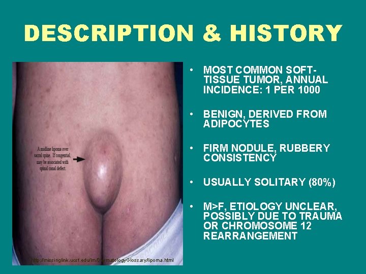 DESCRIPTION & HISTORY • MOST COMMON SOFTTISSUE TUMOR, ANNUAL INCIDENCE: 1 PER 1000 •