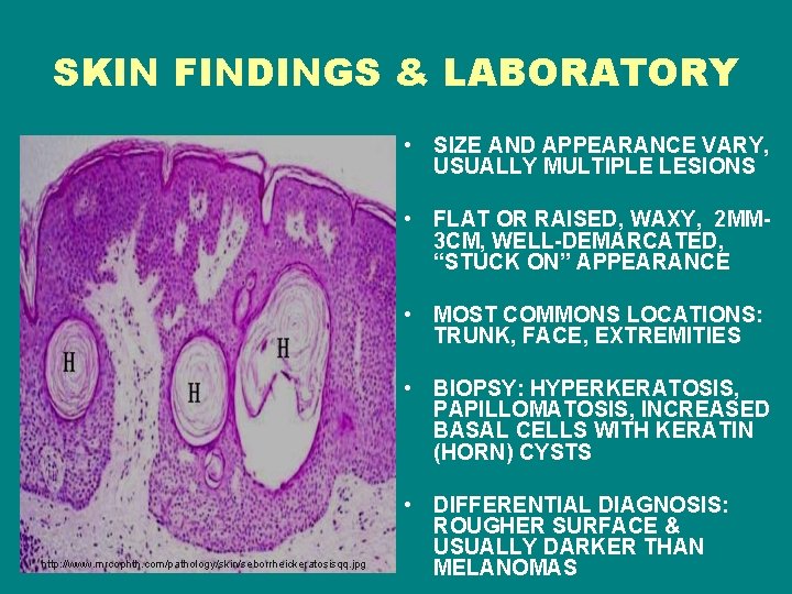 SKIN FINDINGS & LABORATORY • SIZE AND APPEARANCE VARY, USUALLY MULTIPLE LESIONS • FLAT