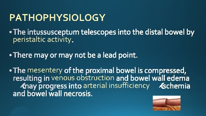 PATHOPHYSIOLOGY peristaltic activity mesentery venous obstruction arterial insufficiency 