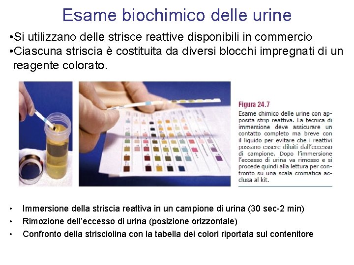 Esame biochimico delle urine • Si utilizzano delle strisce reattive disponibili in commercio •