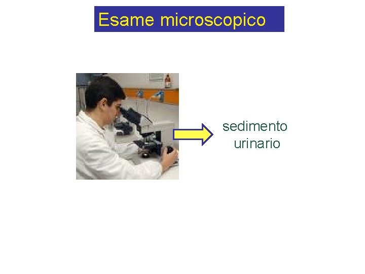 Esame microscopico sedimento urinario 