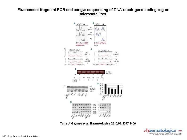 Fluorescent fragment PCR and sanger sequencing of DNA repair gene coding region microsatellites. Terry Fluorescent fragment PCR and sanger sequencing of DNA repair gene coding region microsatellites. Terry