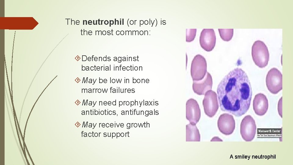 The neutrophil (or poly) is the most common: Defends against bacterial infection May be