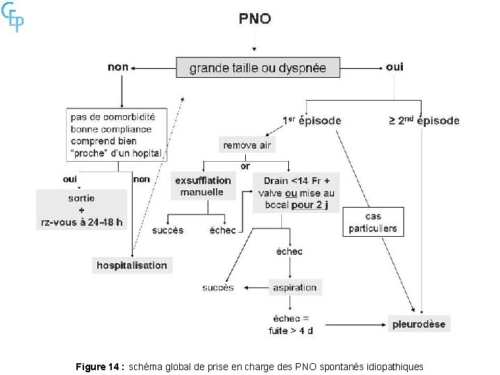 Figure 14 : schéma global de prise en charge des PNO spontanés idiopathiques 