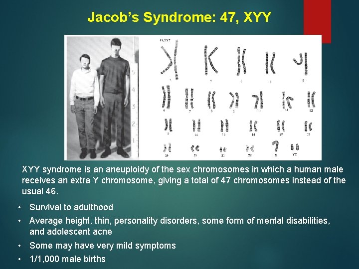 Jacob’s Syndrome: 47, XYY syndrome is an aneuploidy of the sex chromosomes in which