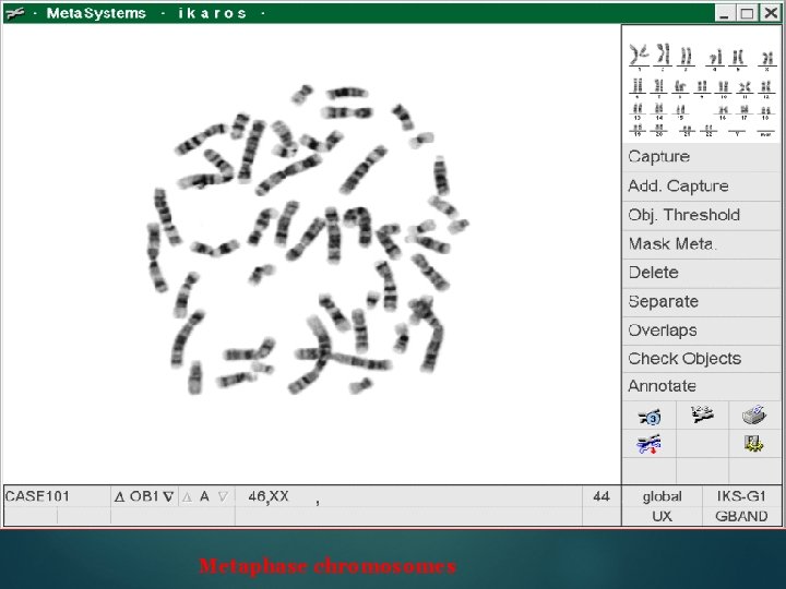 Metaphase chromosomes 