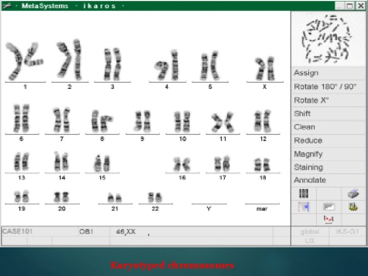 Karyotyped chromosomes 