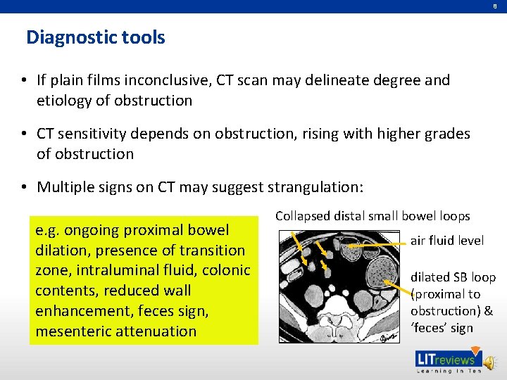 8 Diagnostic tools (SBO) • If plain films inconclusive, CT scan may delineate degree