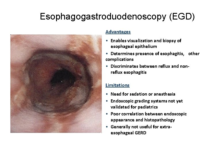 Esophagogastroduodenoscopy (EGD) Advantages • Enables visualization and biopsy of esophageal epithelium • Determines presence