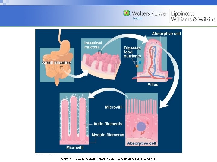 Copyright © 2013 Wolters Kluwer Health | Lippincott Williams & Wilkins 
