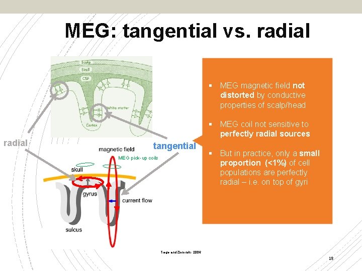 MEG: tangential vs. radial § MEG magnetic field not distorted by conductive properties of