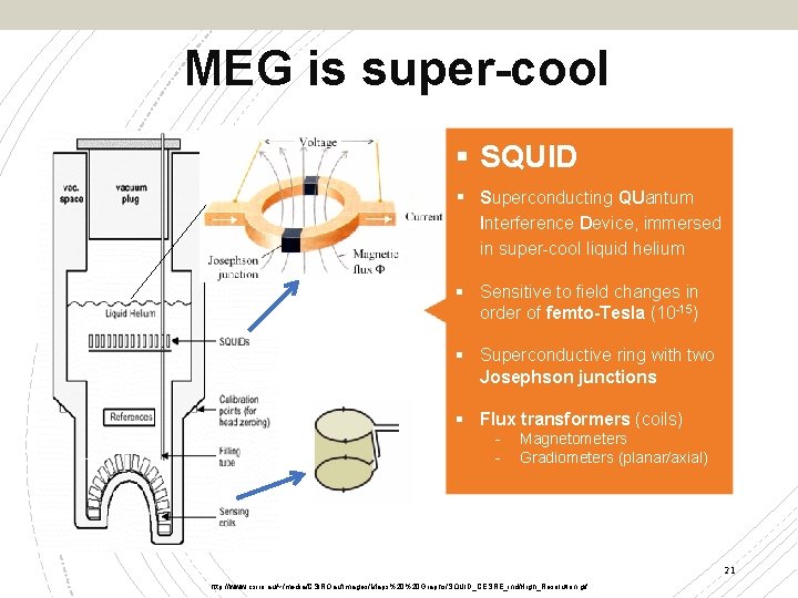 MEG is super-cool § SQUID § Superconducting QUantum Interference Device, immersed in super-cool liquid