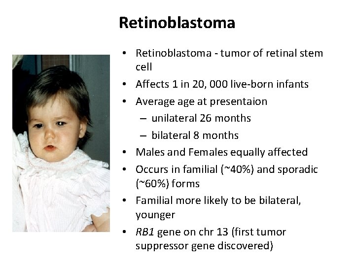 Retinoblastoma • Retinoblastoma - tumor of retinal stem cell • Affects 1 in 20,