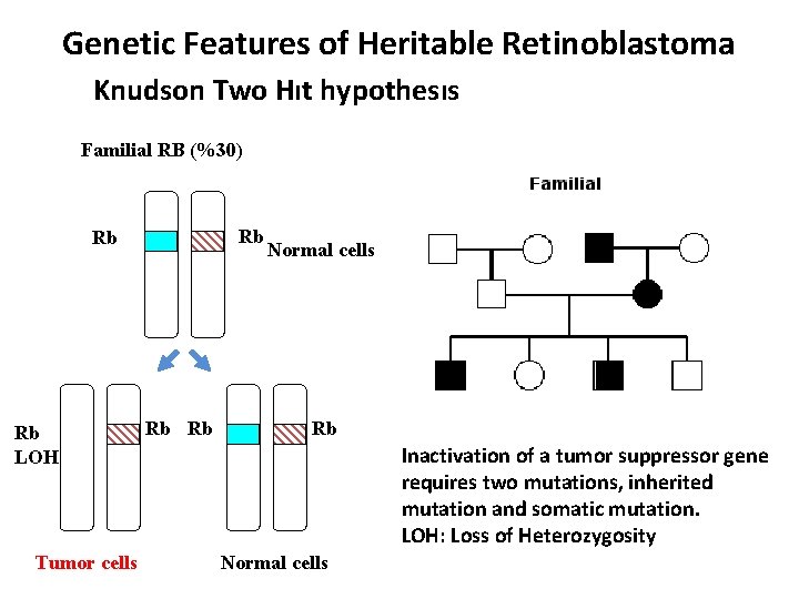 Genetic Features of Heritable Retinoblastoma Knudson Two Hıt hypothesıs Familial RB (%30) Rb Rb