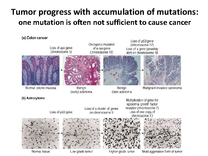 Tumor progress with accumulation of mutations: one mutation is often not sufficient to cause