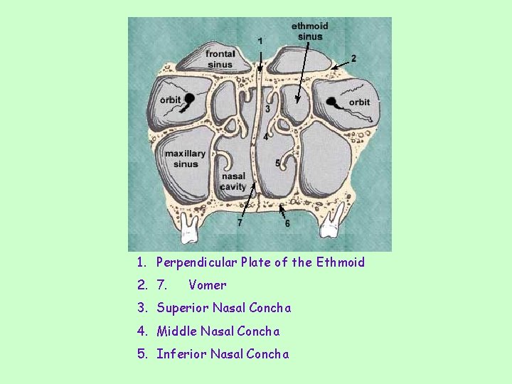 1. Perpendicular Plate of the Ethmoid 2. 7. Vomer 3. Superior Nasal Concha 4.