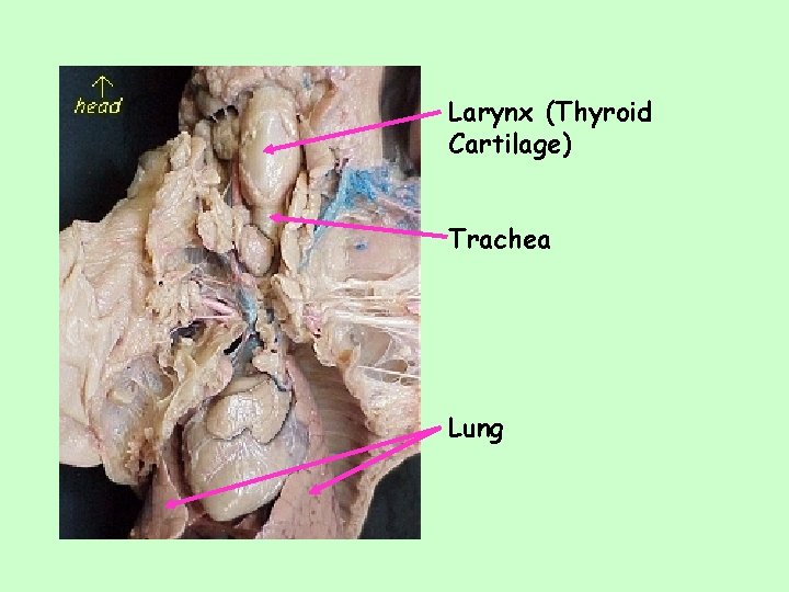 Larynx (Thyroid Cartilage) Trachea Lung 