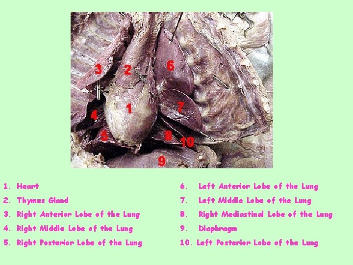 1. 2. 3. 4. 5. Heart Thymus Gland Lung Right Anterior Lobe of the