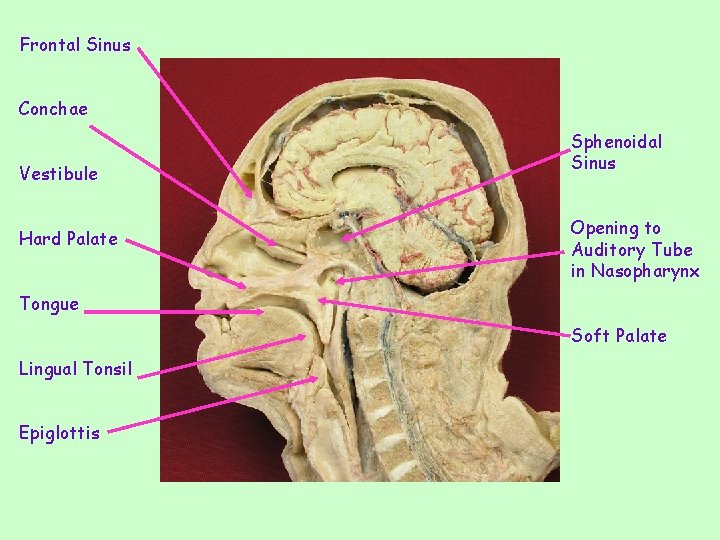 Frontal Sinus Conchae Vestibule Hard Palate Sphenoidal Sinus Opening to Auditory Tube in Nasopharynx