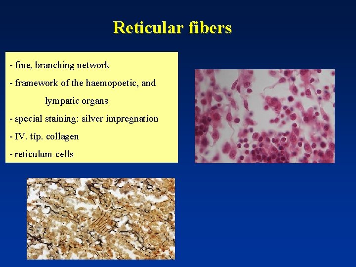 Reticular fibers - fine, branching network - framework of the haemopoetic, and lympatic organs