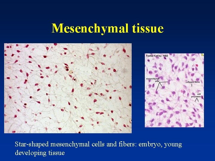 Mesenchymal tissue Star-shaped mesenchymal cells and fibers: embryo, young developing tissue 