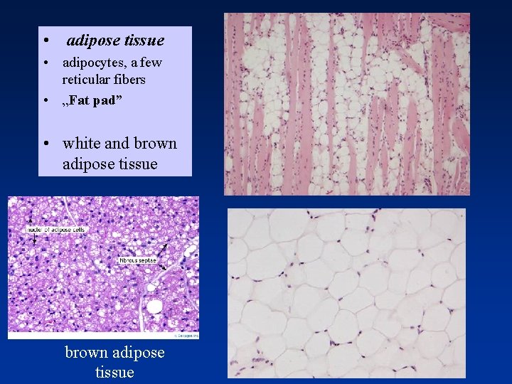  • adipose tissue • adipocytes, a few reticular fibers • „Fat pad” •