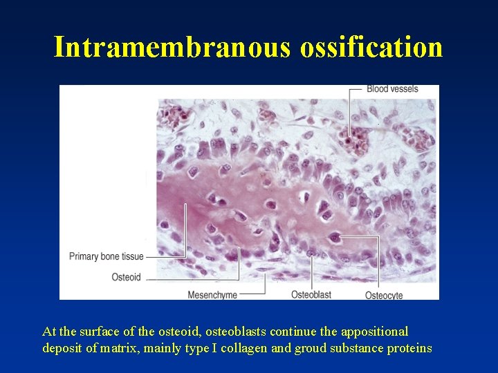 Intramembranous ossification At the surface of the osteoid, osteoblasts continue the appositional deposit of