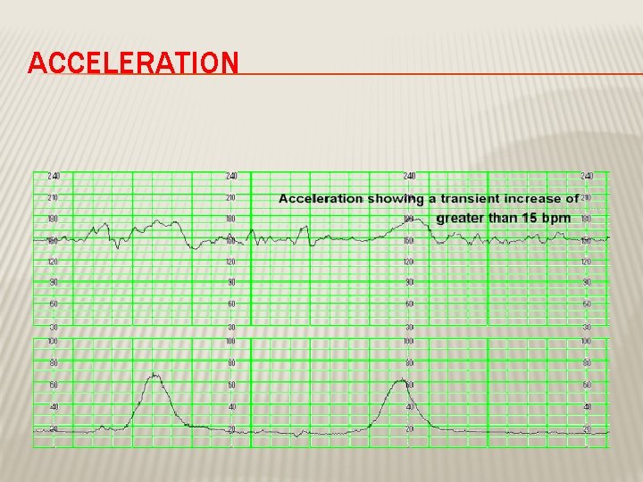 ACCELERATION 