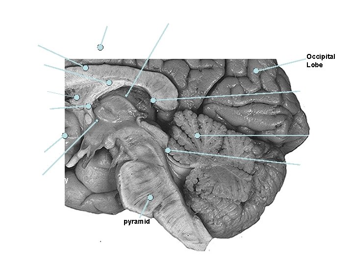 Occipital Lobe y pyramid 