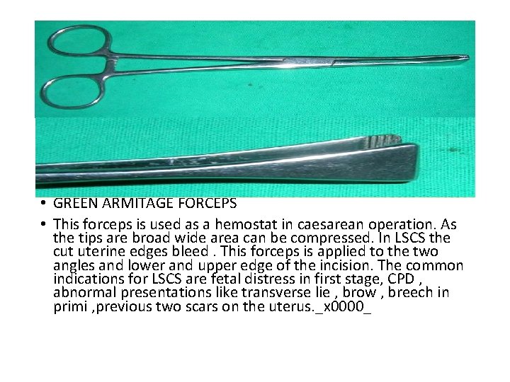  • GREEN ARMITAGE FORCEPS • This forceps is used as a hemostat in