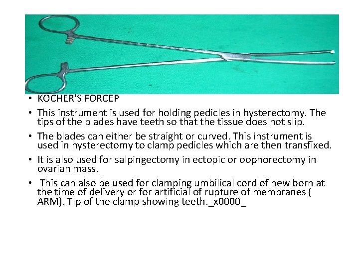  • KOCHER'S FORCEP • This instrument is used for holding pedicles in hysterectomy.