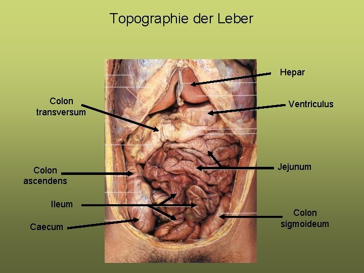 Topographie der Leber Hepar Colon transversum Colon ascendens Ileum Caecum Ventriculus Jejunum Colon sigmoideum