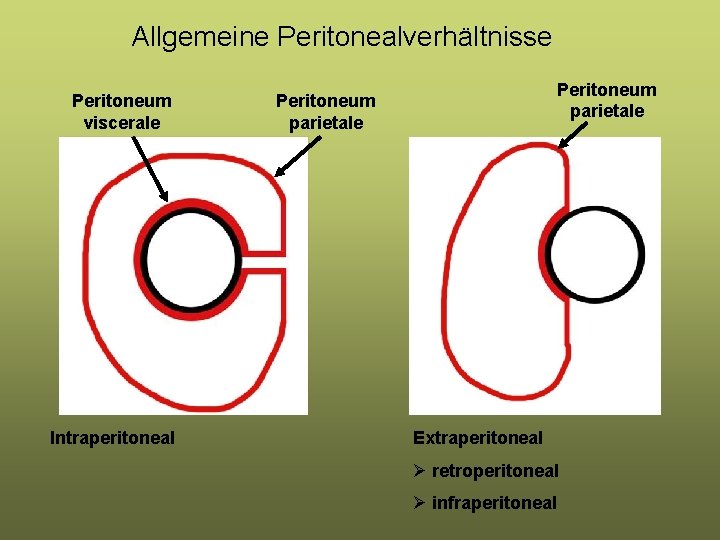 Allgemeine Peritonealverhältnisse Peritoneum viscerale Intraperitoneal Peritoneum parietale Extraperitoneal Ø retroperitoneal Ø infraperitoneal 