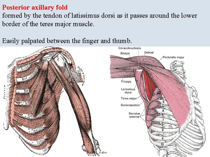 Posterior axillary fold formed by the tendon of latissimus dorsi as it passes around