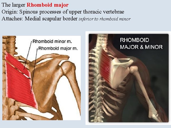 The larger Rhomboid major Origin: Spinous processes of upper thoracic vertebrae Attaches: Medial scapular