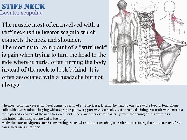 Levator scapulae The muscle most often involved with a stiff neck is the levator