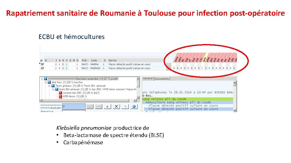 Rapatriement sanitaire de Roumanie à Toulouse pour infection post-opératoire ECBU et hémocultures Klebsiella pneumoniae