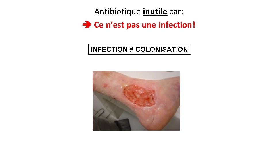 Antibiotique inutile car: Ce n’est pas une infection! INFECTION ≠ COLONISATION 