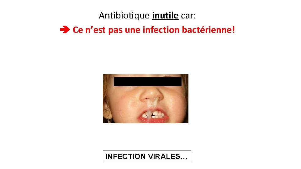 Antibiotique inutile car: Ce n’est pas une infection bactérienne! INFECTION VIRALES… 