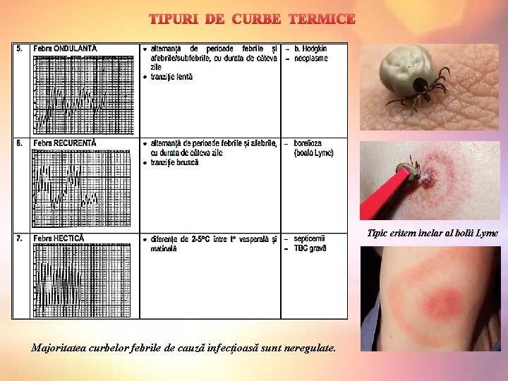 TIPURI DE CURBE TERMICE Tipic eritem inelar al bolii Lyme Majoritatea curbelor febrile de